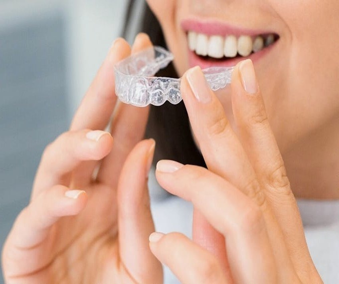 durata trattamento invisalign